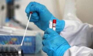 Во Владимирской области выявлено более 20 случаев нового штамма коронавируса «Омикрон»